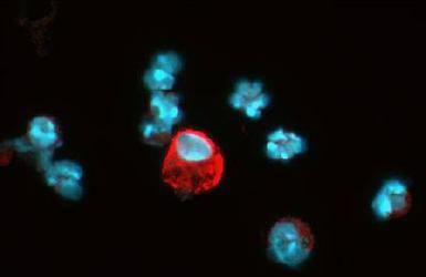 <h6 id="pdp-product-imgtitle"> HIF1A Antibody (MA1-16518) </h6><p id="pdp-product-imgdesc"> Detection of HIF-1 alpha (red dye) in a cell cytospin from a lavage of a murine skin pouch infected with Staph Aureus, using MA1-16518. 100X magnification. Blue dye is DAPI nuclear staining. </p>