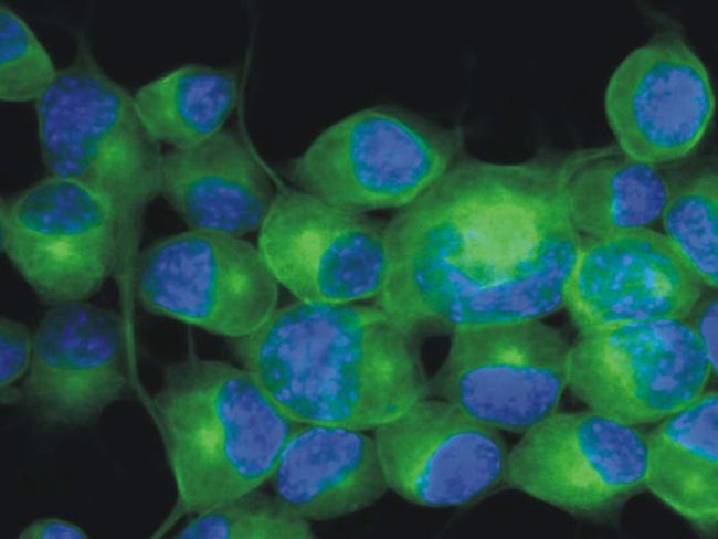 <h6 id="pdp-product-imgtitle"> beta-3 Tubulin Antibody (MA1-19582) in IF </h6><p id="pdp-product-imgdesc"> Immunofluorescent analysis of beta-3 Tubulin using a monoclonal antibody (Product # MA1-19582). </p>