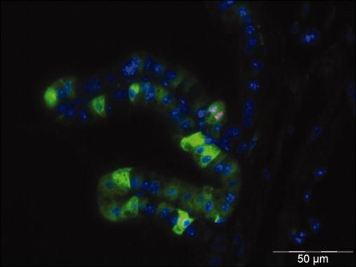<h6 id="pdp-product-imgtitle"> Phospho-Histone H3 pSer28 Antibody (MA1-24751) </h6><p id="pdp-product-imgdesc"> Immunofluorescent analysis of Phospho-Histone H3 pSer28 in mouse anterior prostate using a Phospho-Histone H3 pSer28 monoclonal antibody (Product # MA1-24751) at a dilution of 1:2000 (red) and a phospho-S6 (pSer235/236) antibody (green). Nuclei were stained using DAPI (blue). </p>