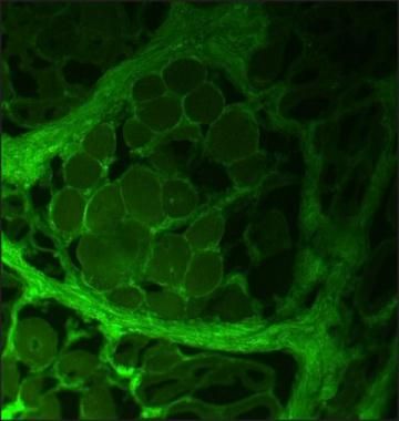 <h6 id="pdp-product-imgtitle"> Collagen I Antibody (MA1-26771) </h6><p id="pdp-product-imgdesc"> Immunofluorescent analysis of Collagen I in acetone-fixed, frozen sections of pig tongue using a Collagen I monoclonal antibody (Product # MA1-26771) at a dilution of 1:4000 and detected using a Goat anti-Mouse IgG, FITC conjugate. </p>