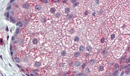 Immunohistochemical analysis of formalin-fixed paraffin-embedded skin, sebaceous gland, human using a TM9SF3 polyclonal antibody (Product # PA5-34267) at a 10 ug/ml dilution. Heat-induced antigen retrieval was performed prior to staining.