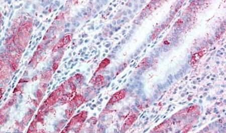 Immunohistochemical analysis of formalin-fixed paraffin-embedded human, stomach using a TSPAN13/TM4SF13 polyclonal antibody (Product # PA5-34297). Heat-induced antigen retrieval was performed prior to staining.