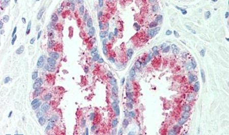 Immunohistochemical analysis of formalin-fixed paraffin-embedded human, prostate using a TSPAN13/TM4SF13 polyclonal antibody (Product # PA5-34297). Heat-induced antigen retrieval was performed prior to staining.
