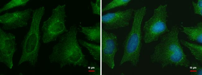 Immunofluorescent analysis of CNPPD1 showing staining in the cytoplasm of HeLa cells. HeLa cells were fixed in ice-cold MeOH for 5 min and stained using a CNPPD1 polyclonal antibody (Product # PA5-34673) diluted at 1:500. Blue: Hoechst 33342 staining.