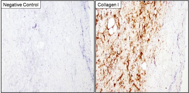 Immunohistochemistry analysis of Collagen I was performed on porcine skin tissue. To expose target proteins, antigen retrieval was performed by microwaving tissues for 8-15 minutes in 10mM sodium citrate buffer (pH 6.0). Following antigen retrieval, tissues were blocked in 3% hydrogen peroxide-methanol for 15 min at room temperature, washed with deionized water and PBS, and then probed with a Collagen I monoclonal antibody (Product # MA1-141) diluted 1:20 in 3% BSA-PBS (right panel) or incubated with buffer alone not containing primary antibody as a negative control (left panel), overnight at 4°C in a humidified chamber. Tissues were washed extensively in PBST and detection was performed using an HRP-conjugated secondary antibody followed by colorimetric detection using a DAB kit. Tissues were counterstained with hematoxylin and dehydrated with ethanol and xylene to prep for mounting.