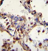 Immunohistochemistry analysis of WDR52 in formalin-fixed, paraffin-embedded human lung tissue using a WDR52 polyclonal antibody (Product # PA5-35056) followed by peroxidase conjugation of the secondary antibody and DAB staining.
