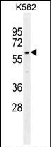Western blot analysis of WDR42C in K562 cell lysate (35ug/lane) using a WDR42C polyclonal antibody (Product # PA5-35082).