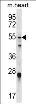 Western blot analysis of FOXO6 in mouse heart tissue lysate (35ug/lane) using a FOXO6 polyclonal antibody (Product # PA5-35117).