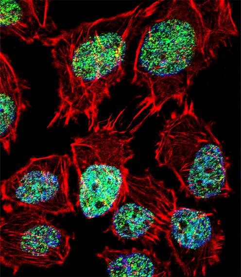 Immunofluorescent analysis of FOXO6 showing staining in the cytoplasm and nucleus of U-251 cells using a FOXO6 polyclonal antibody (Product # PA5-35117) followed by detection using a fluorescent conjugated secondary antibody (green). Cytoplasmic actin was stained with a fluorescent red phalloidin (7units/ml, 1 h at 37°C). Nuclei were stained with DAPI (blue) (10 ug/ml, 10 min).