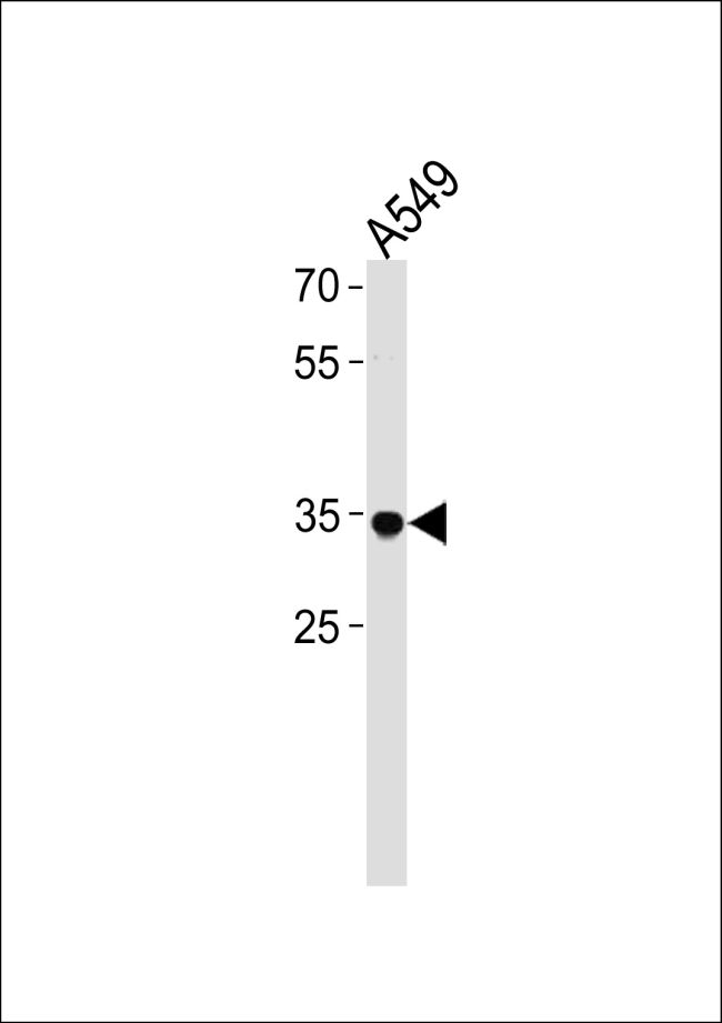 Western blot analysis of RHOXF2B in A549 cell lysate (35ug/lane) using a RHOXF2B polyclonal antibody (Product # PA5-35225).
