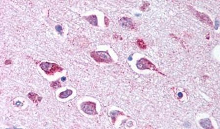 Immunohistochemical analysis of formalin-fixed paraffin-embedded human brain, neurons and glia using a TLL2 polyclonal antibody (Product # PA5-34265). Heat-induced antigen retrieval was performed prior to staining.