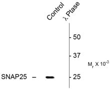 Western blot analysis of Phospho-SNAP-25 pSer187 in rat hippocampal lysate using a Phospho-SNAP-25 pSer187 polyclonal antibody (Product # PA5-35406). Results show a band at ~25kDa. Phosphospecificity is shown in the right lane where the signal is completely eliminated by treatment with lambda phosphatase (l-Ptase, 400 units/100ul lysate for 30 min).
