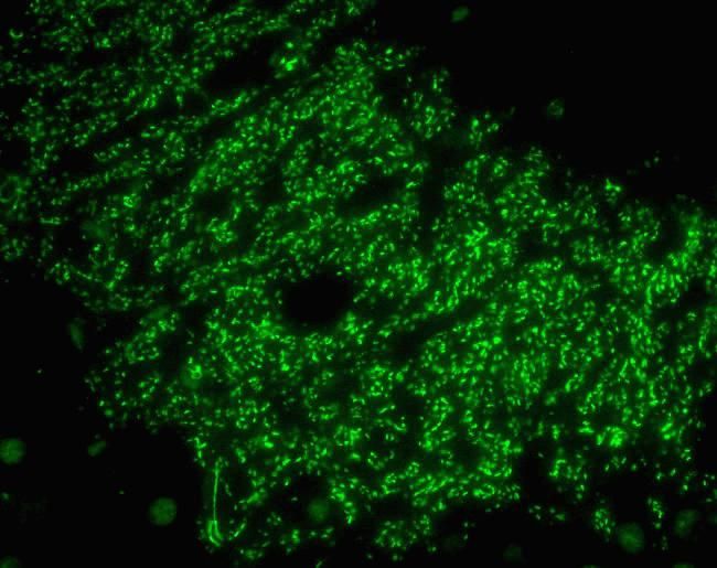 Immunohistochemistry analysis of Afadin in formalin-fixed, paraffin-embedded mouse hippocampal tissue using an Afadin monoclonal antibody (Product # 700193) at a dilution of 1ug/ml. Results show staining of mossy fiber terminals in the CA3 region.