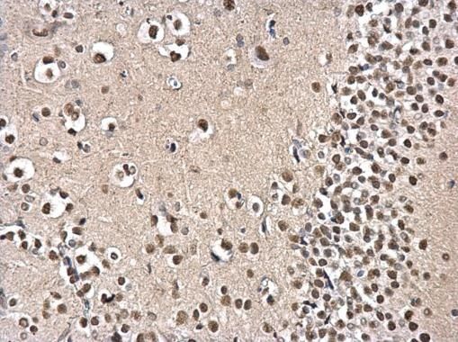 Immunohistochemical analysis of PSPC1 in the nucleus of paraffin-embedded rat fore brain tissue using a PSPC1 polyclonal antibody (Product # PA5-35958) at a dilution of 1:500.