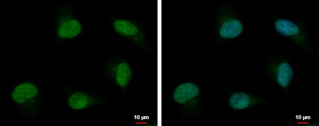 Immunofluorescent analysis of PSPC1 showing staining in the nucleus of HeLa cells. HeLa cells were fixed in 4% paraformaldehyde at RT for 15 min and stained using a PSPC1 polyclonal antibody (Product # PA5-35958) diluted at 1:500. Blue: Hoechst 33342 staining.