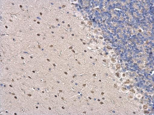 Immunohistochemical analysis of PSPC1 in the nucleus of paraffin-embedded mouse hind brain tissue using a PSPC1 polyclonal antibody (Product # PA5-35958) at a dilution of 1:500.