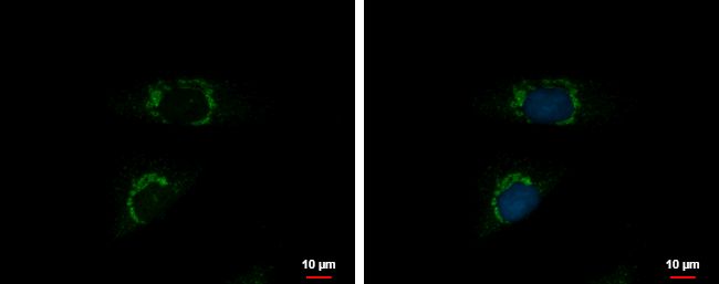 Immunofluorescent analysis of INTU showing staining in the cytoplasm of SKNSH cells. SKNSH cells were fixed in 4% paraformaldehyde at RT for 15 min and stained using an INTU polyclonal antibody (Product # PA5-35900) diluted at 1:500. Blue: Hoechst 33342 staining.