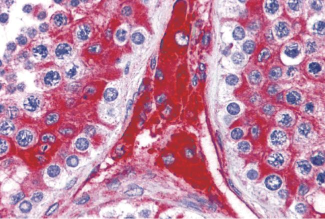 Immunohistochemical staining of human testis tissue using a WDR35 polyclonal antibody (Product # PA5-34370) at a 5 ug/mL dilution.
