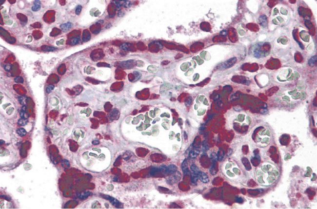 Immunohistochemical staining of human placenta tissue using a KPNA7 polyclonal antibody (Product # PA5-34372) at a 5 ug/mL dilution.