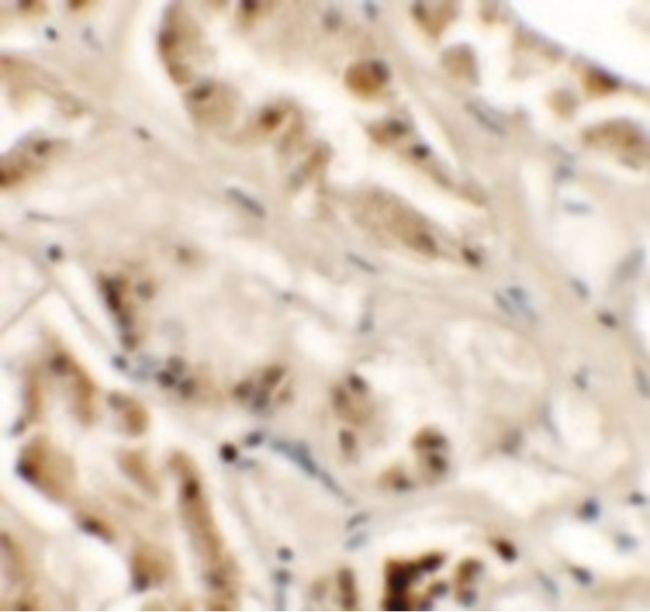 Immunohistochemical staining of human kidney tissue using a GZF1 polyclonal antibody (Product # PA5-34375) at a 25 ug/mL dilution.
