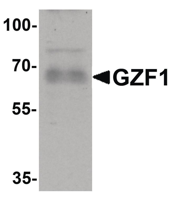 Western blot analysis of human heart tissue lysate using a GZF1 polyclonal antibody (Product # PA5-34375) at 1 ug/mL.