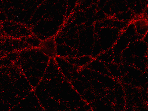 Cat. No. 141 013 Indirect immunostaining of rat hippocampus neurons (dilution 1 : 500).