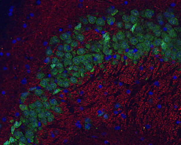 Cat. No. 141 003 Indirect immunostaining of PFA fixed paraffin embedded mouse hippocampus section with anti-bassoon (dilution 1 : 500; red) and Guinea pig anti-NeuN (cat. no. 266 004, dilution 1 : 500; green). Nuclei have been visualized by DAPI staining (blue).