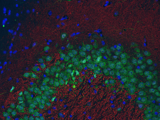 Cat. No. 141 013 Indirect immunostaining of PFA fixed paraffin embedded mouse hippocampus section with anti-bassoon (dilution 1 : 500; red) and Guinea pig anti-NeuN (cat. no. 266 004, dilution 1 : 500; green). Nuclei have been visualized by DAPI staining (blue).