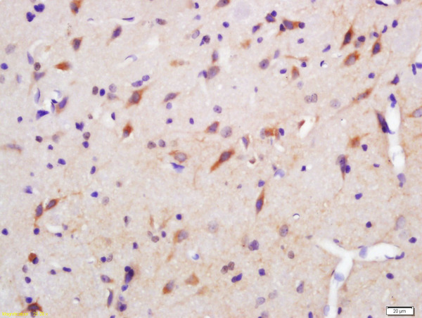 Formalin-fixed and paraffin embedded rat brain labeled with Anti-LASS4 Polyclonal Antibody, Unconjugated (bs-5079R) at 1:300 followed by conjugation to the secondary antibody and DAB staining.