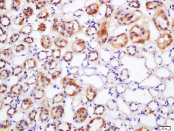 Formalin-fixed and paraffin embedded rat kidney labeled with Rabbit Anti-LASS4 Polyclonal Antibody, Unconjugated (bs-5079R) at 1:200 followed by conjugation to the secondary antibody and DAB staining.