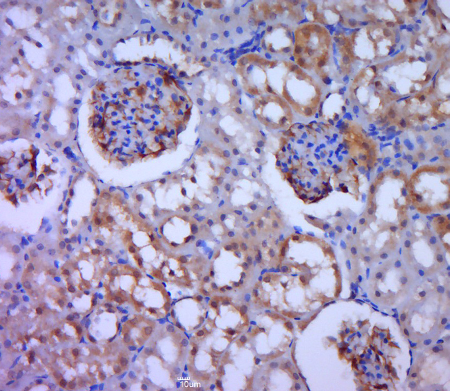 Paraformaldehyde-fixed, paraffin embedded rat kidney; Antigen retrieval by boiling in sodium citrate buffer (pH6.0) for 15min; Block endogenous peroxidase by 3% hydrogen peroxide for 20 minutes; Blocking buffer (normal goat serum) at 37°C for 30min; Antibody incubation with MDGA2 Polyclonal Antibody, Unconjugated (bs-11092R) at 1:400 overnight at 4°C, followed by a conjugated secondary for 20 minutes and DAB staining.