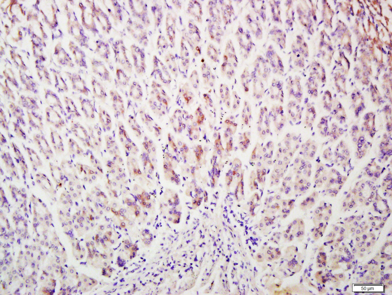 Paraformaldehyde-fixed, paraffin embedded Mouse stomach; Antigen retrieval by boiling in sodium citrate buffer (pH6.0) for 15min; Block endogenous peroxidase by 3% hydrogen peroxide for 20 minutes; Blocking buffer (normal goat serum) at 37°C for 30min; Antibody incubation with NSMAF Polyclonal Antibody, Unconjugated (bs-13656R) at 1:400 overnight at 4°C, followed by a conjugated secondary antibody for 20 minutes and DAB staining.
