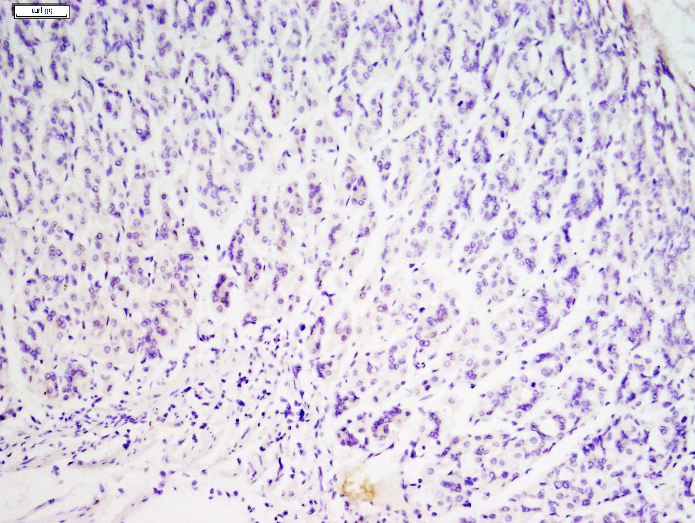 Paraformaldehyde-fixed, paraffin embedded Mouse stomach; Antigen retrieval by boiling in sodium citrate buffer (pH6.0) for 15min; Block endogenous peroxidase by 3% hydrogen peroxide for 20 minutes; Blocking buffer (normal goat serum) at 37°C for 30min; Antibody incubation with NSMAF Polyclonal Antibody, Unconjugated (bs-13656R) ,followed by polypeptide blocking at 1:400 overnight at 4°C, followed by a conjugated secondary antibody for 20 minutes and DAB staining.