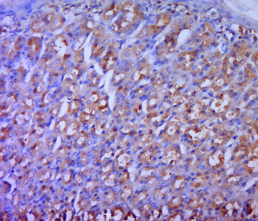 Paraformaldehyde-fixed, paraffin embedded rat stomach; Antigen retrieval by boiling in sodium citrate buffer (pH6.0) for 15min; Block endogenous peroxidase by 3% hydrogen peroxide for 20 minutes; Blocking buffer (normal goat serum) at 37°C for 30min; Antibody incubation with ODC Polyclonal Antibody, Unconjugated (bs-1294R) at 1:400 overnight at 4°C, followed by a conjugated secondary for 20 minutes and DAB staining.