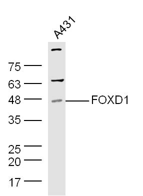 Human A431 cell lysates probed with Rabbit Anti-Pan FOXD Polyclonal Antibody, Unconjugated (bs-12193R) at 1:300 overnight at 4˚C. Followed by conjugation to secondary antibody (bs-0295G-HRP) at 1:500 for 90 min at 37˚C.