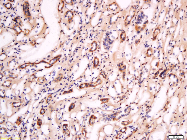 Formalin-fixed and paraffin embedded human kidney labeled with Anti- Pan FOXD Polyclonal Antibody, Unconjugated (bs-12193R) at 1:200 followed by conjugation to the secondary antibody and DAB staining.