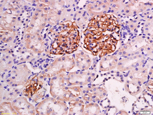 Paraformaldehyde-fixed, paraffin embedded mouse kidney tissue; Antigen retrieval by boiling in sodium citrate buffer(pH6) for 15min; Block endogenous peroxidase by 3% hydrogen peroxide for 30 minutes; Blocking buffer (normal goat serum) at 37°C for 20min; Antibody incubation with Rabbit Anti-Podocin Polyclonal Antibody, Unconjugated (bs-6597R) at 1:200 overnight at 4°C, followed by a conjugated secondary and DAB staining