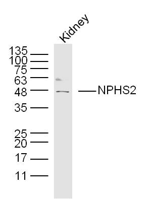 Mouse kidney lysates probed with Podocin Polyclonal Antibody, unconjugated (bs-6597R) at 1:300 overnight at 4°C followed by a conjugated secondary antibody at 1:10000 for 90 minutes at 37°C.