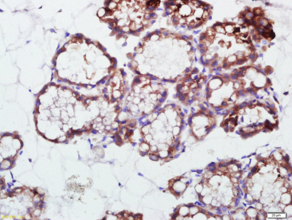 Paraformaldehyde-fixed, paraffin embedded rat mammary gland); Antigen retrieval by boiling in sodium citrate buffer (pH6) for 15min; Block endogenous peroxidase by 3% hydrogen peroxide for 30 minutes; Blocking buffer (normal goat serum) at 37°C for 20min; Antibody incubation with \\tPRKCDBP Polyclonal Antibody, Unconjugated ( \\tbs-6085R ) at 1:500 overnight at 4°C, followed by a conjugated secondary and DAB staining.