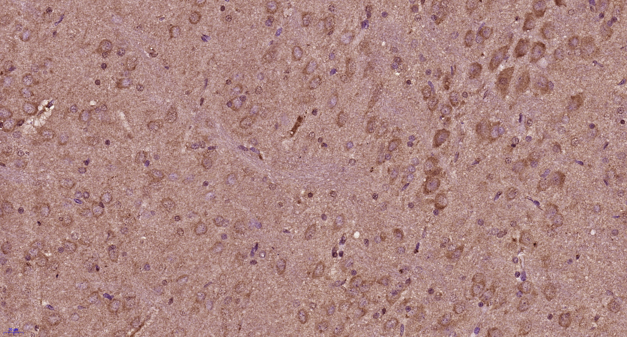 Paraformaldehyde-fixed, paraffin embedded rat brain; Antigen retrieval by boiling in sodium citrate buffer (pH6) for 15min; Block endogenous peroxidase by 3% hydrogen peroxide for 30 minutes; Blocking buffer (normal goat serum) at 37°C for 20min; Antibody incubation with Progestin Receptor Beta/MPRB Antibody(bs-11410R) at 1:400 overnight at 4°C, followed by a conjugated secondary and DAB staining.