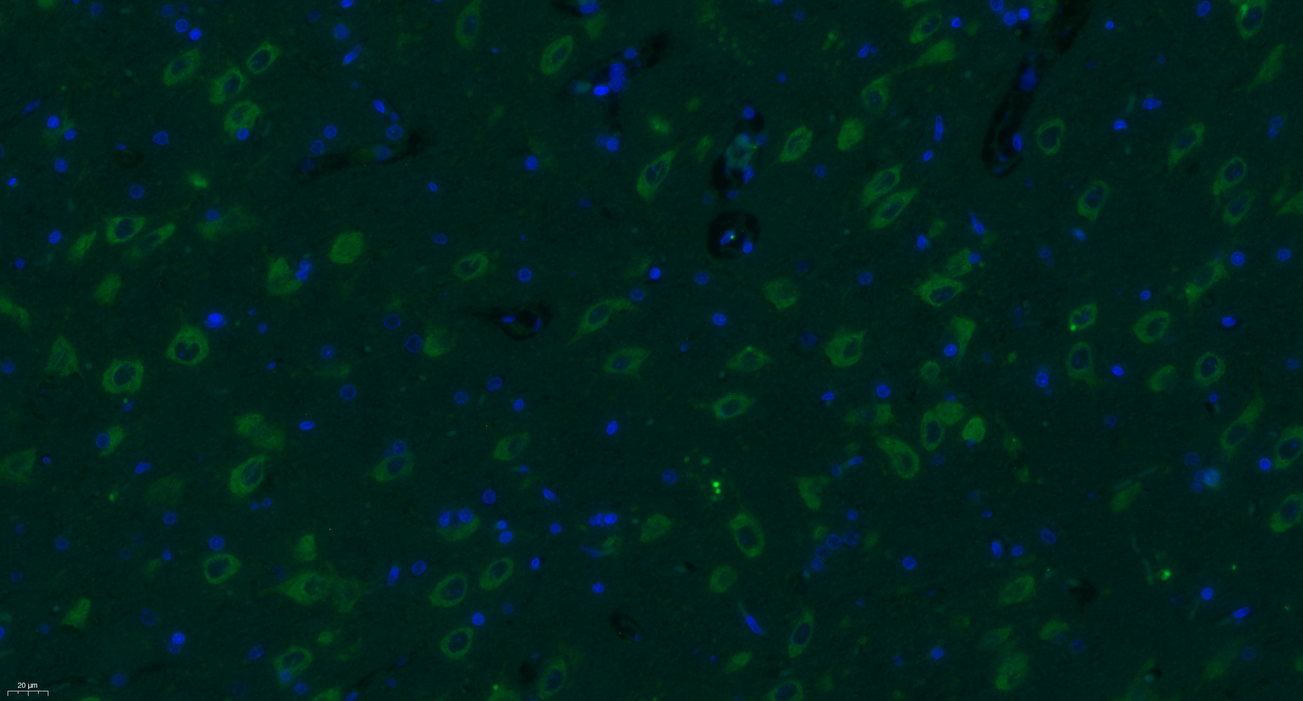 Paraformaldehyde-fixed, paraffin embedded rat brain; Antigen retrieval by boiling in sodium citrate buffer (pH6) for 15min; Block endogenous peroxidase by 3% hydrogen peroxide for 30 minutes; Blocking buffer (normal goat serum) at 37°C for 20min; Antibody incubation with Progestin Receptor Beta/MPRB Antibody (bs-11410R) at 1:400 overnight at 4°C, followed by a conjugated secondary Goat Anti-Rabbit IgG antibody (bs-0295G-FITC) for 90 minutes, and DAPI for nuclei staining.