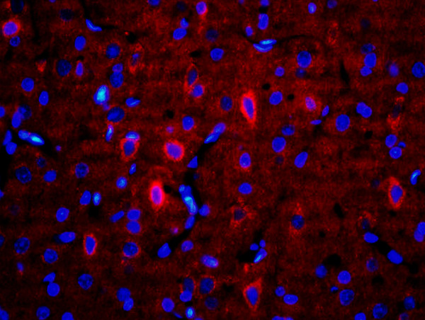 Formalin-fixed and paraffin-embedded rat brain labeled with Anti-RALDH2 Polyclonal Antibody, Unconjugated(bs-3676R) 1:200, overnight at 4°C, The secondary antibody was Goat Anti-Rabbit IgG,Cy3 conjugated(bs-0295G-Cy3)used at 1:200 dilution for 40 minutes at 37°C.\\n