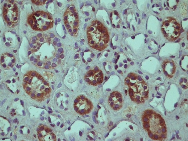 This image was kindly submitted by Horea Rus of the University of Maryland.\\nParaffin embedded Human kidney tissue; Stained with Rabbit Anti-RGC-32 Polyclonal Antibody, Unconjugated (bs-9079R) at 1:200 dilution followed by the RTU Vectastain kit from Vector.