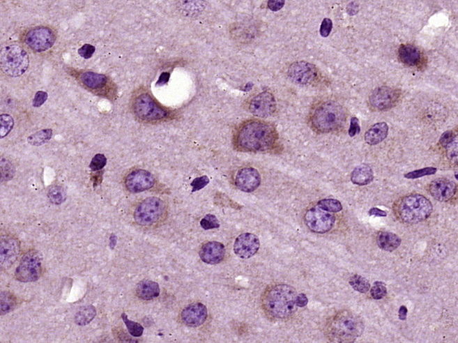 Paraformaldehyde-fixed, paraffin embedded mouse brain; Antigen retrieval by boiling in sodium citrate buffer (pH6) for 15min; Block endogenous peroxidase by 3% hydrogen peroxide for 30 minutes; Blocking buffer (normal goat serum) at 37°C for 20min; Antibody incubation with RNF128 Polyclonal Antibody (bs-9251R) at 1:400 overnight at 4°C, followed by a conjugated secondary and DAB staining.