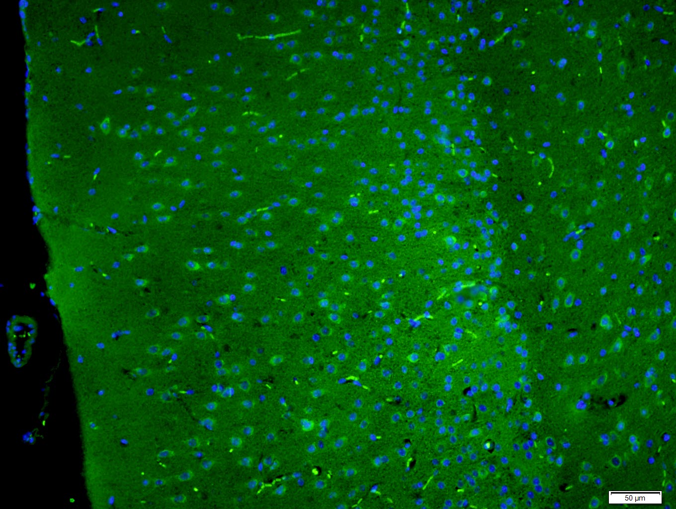 Paraformaldehyde-fixed, paraffin embedded Mouse brain; Antigen retrieval by boiling in sodium citrate buffer (pH6.0) for 15min; Block endogenous peroxidase by 3% hydrogen peroxide for 20 minutes; Blocking buffer (normal goat serum) at 37°C for 30min; Antibody incubation with SAPAP4/DLGAP4 Polyclonal Antibody, Unconjugated (bs-12140R) at 1:400 overnight at 4°C, followed by a conjugated secondary antibody for 90 minutes and DAPI for nuclei staining.