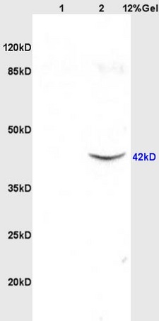 Lane 1: rat brain lysates Lane 2: mouse intestine lysates probed with Anti SRG4/TSARG4 Polyclonal Antibody, Unconjugated (bs-1220R) at 1:200 in 4˚C. Followed by conjugation to secondary antibody (bs-0295G-HRP) at 1:3000 90min in 37˚C. Predicted band 42kD. Observed band size: 42kD.