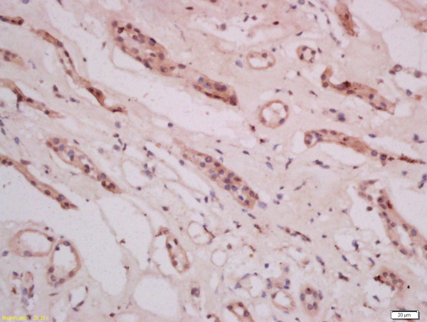Formalin-fixed and paraffin embedded human kidney tissue labeled with Anti-THEMIS Polyclonal Antibody, Unconjugated(bs-12329R) 1:400 followed by conjugation to the secondary antibody and DAB staining
