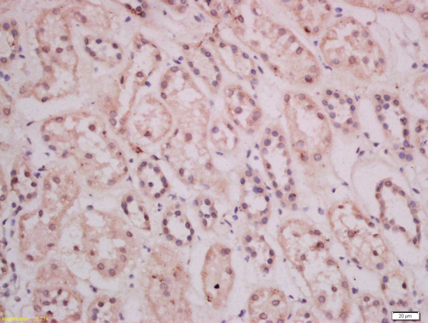 Formalin-fixed and paraffin embedded human kidney tissue labeled with Anti-THEMIS Polyclonal Antibody, Unconjugated(bs-12329R) 1:400 followed by conjugation to the secondary antibody and DAB staining