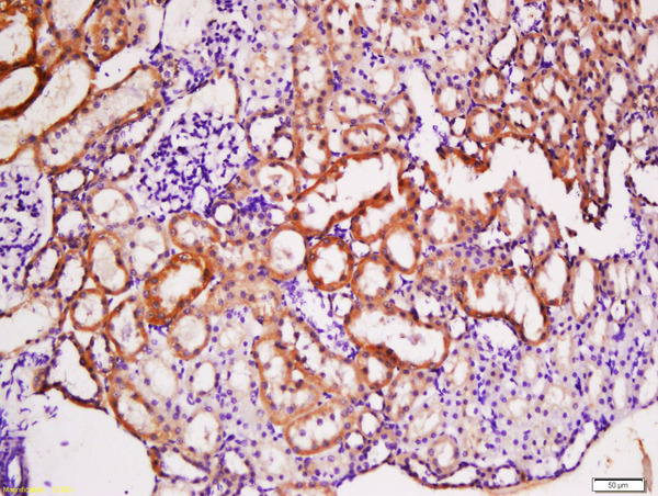 Formalin-fixed and paraffin embedded rat kidney labeled with Anti-TNFRSF13B Polyclonal Antibody, Unconjugated (bs-2773R) at 1:200 followed by conjugation to the secondary antibody and DAB staining.