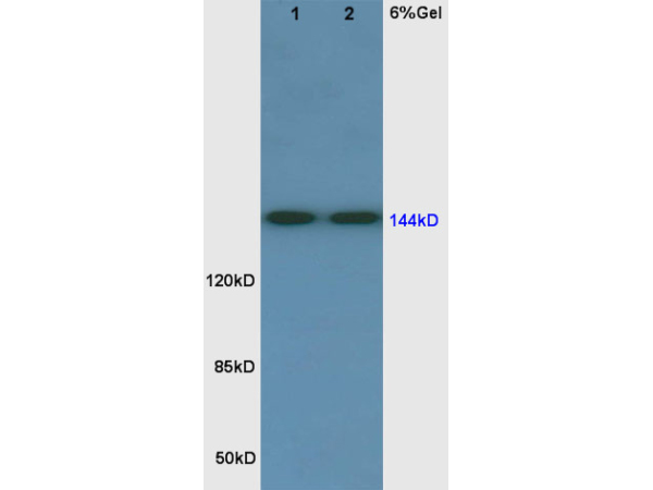 Rat lung lysates 30ug, probed (bs-0170R) at 1:200 overnight in 4˚C. Followed by conjugation to the secondary antibody (bs-0295G-HRP) at 1:3000 90min in 37˚C. Predicted and observed band size 144kDa.
